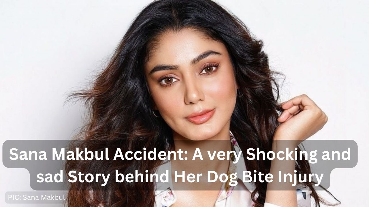 Sana Makbul Accident: A very Shocking and sad Story behind Her Dog Bite Injury