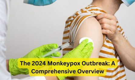 The 2024 Monkeypox Outbreak: A Comprehensive Overview