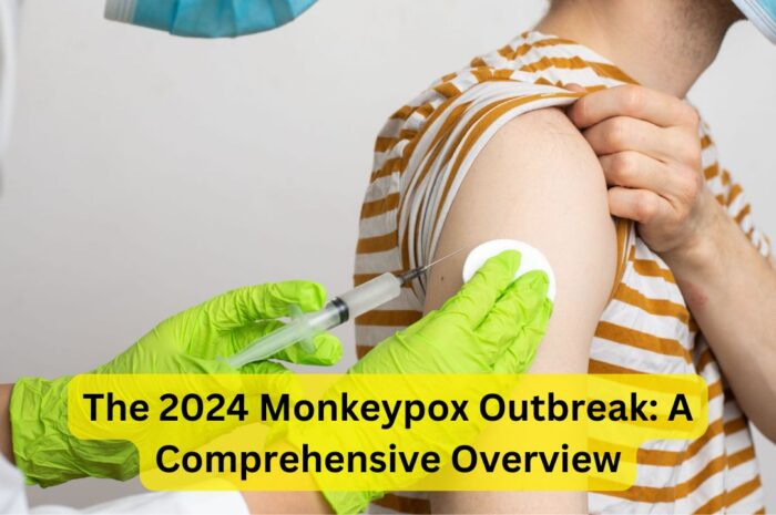 The 2024 Monkeypox Outbreak: A Comprehensive Overview